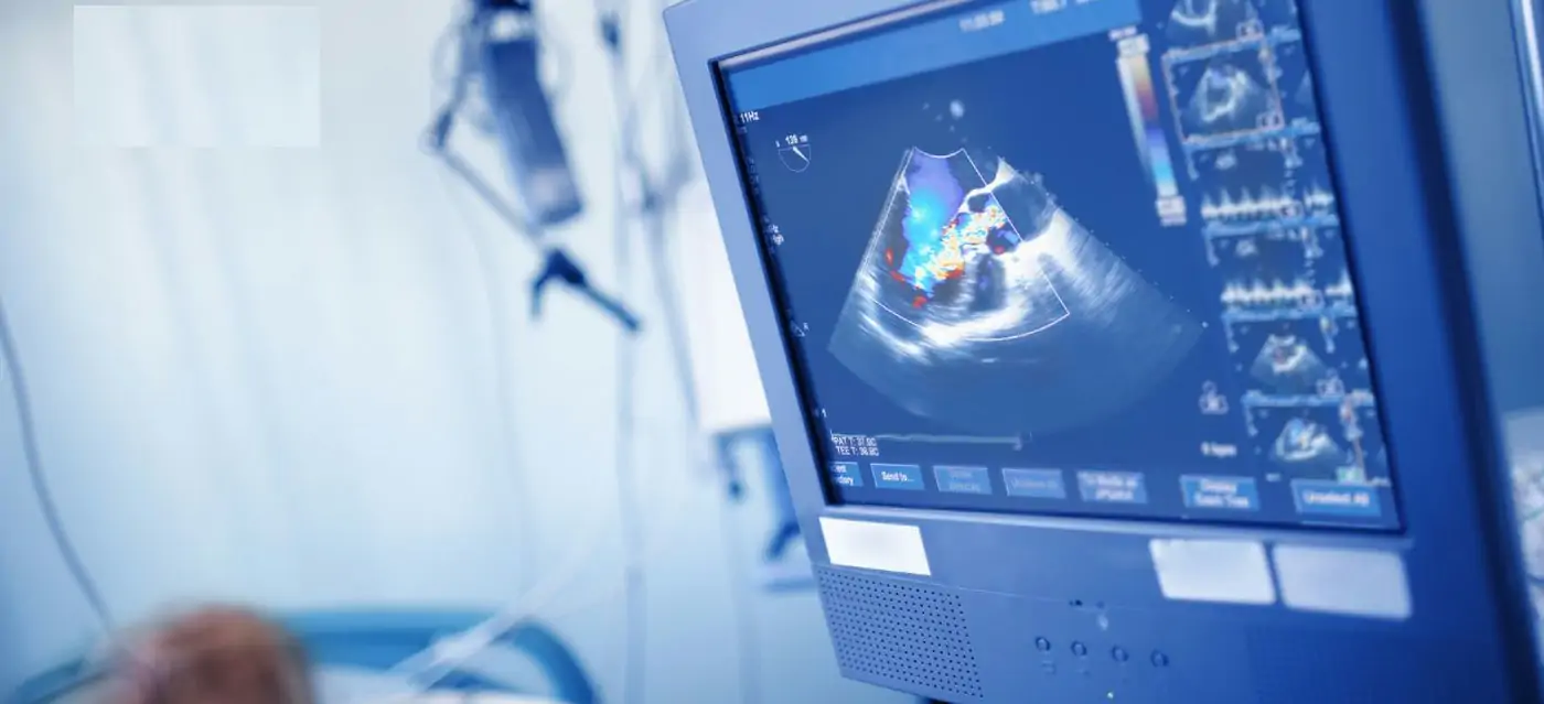 Ultrasound, Echo & Doppler