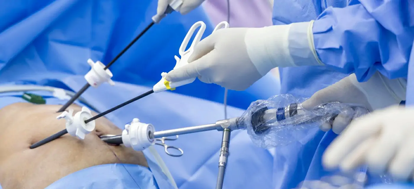 General & Minimal Invasive Surgery